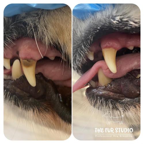 Teeth-cleaning-1-session-result